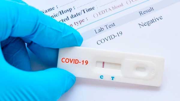 Profesionalhoreca, test de antígenos Covid-19